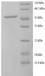 SDS-PAGE
