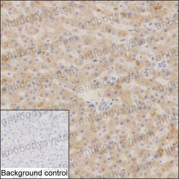 Валидация AntibodySystem RHE85802