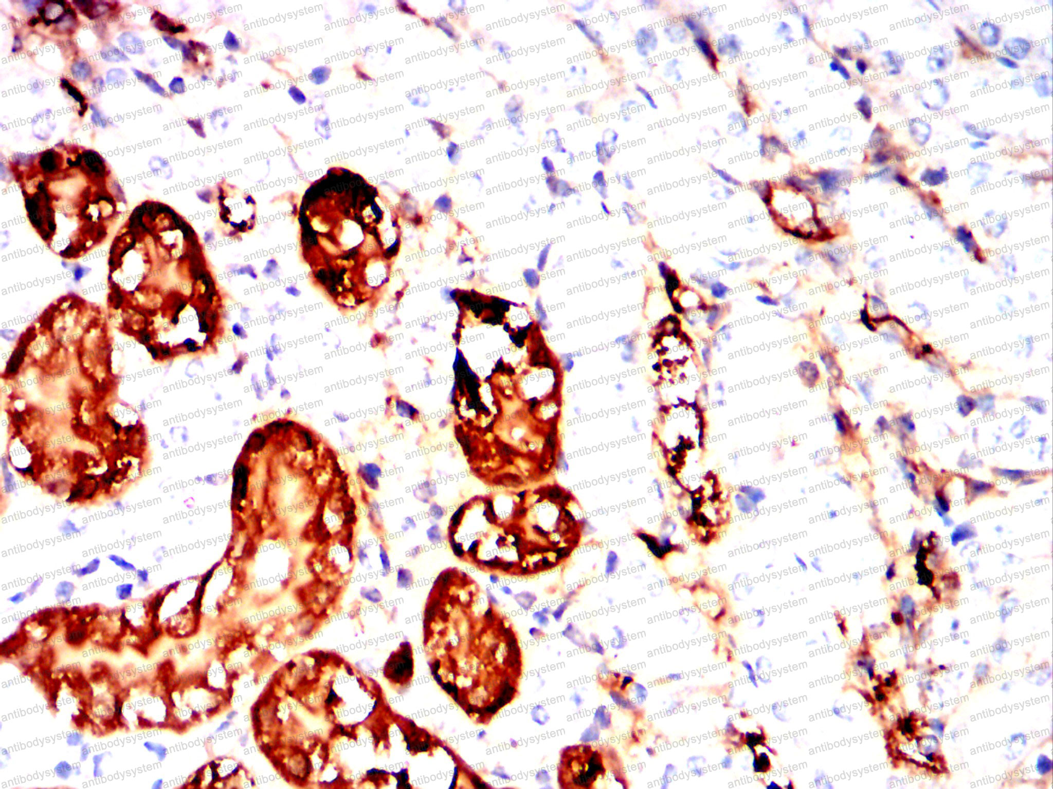 Валидация AntibodySystem RHJ73202 (3536)