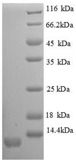 SDS-PAGE