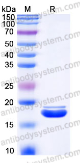 EHJ47901, SDS-PAGE