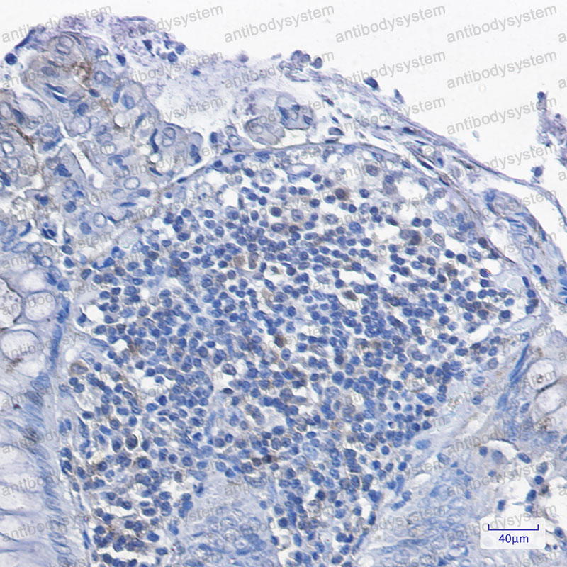 Валидация AntibodySystem RMG05501