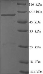 SDS-PAGE