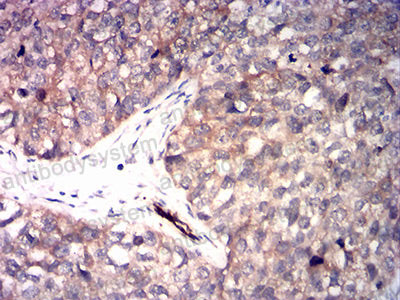 Валидация AntibodySystem RHD60802 (1675)