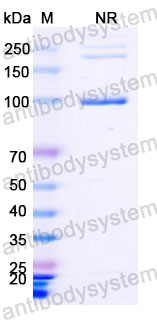 Валидация SDS-PAGE - AntibodySystem DHG01305