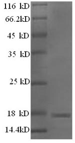 SDS-PAGE