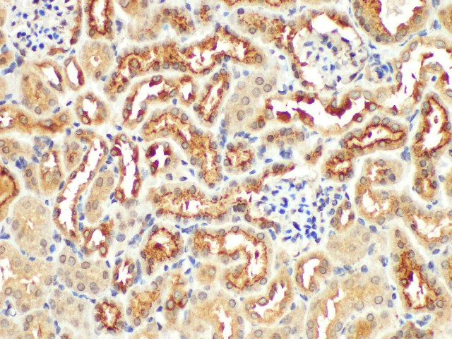 Иммуногистохимия, Angiotensinogen, ткань почки мыши