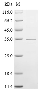 SDS-PAGE