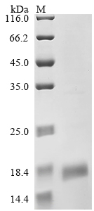SDS-PAGE