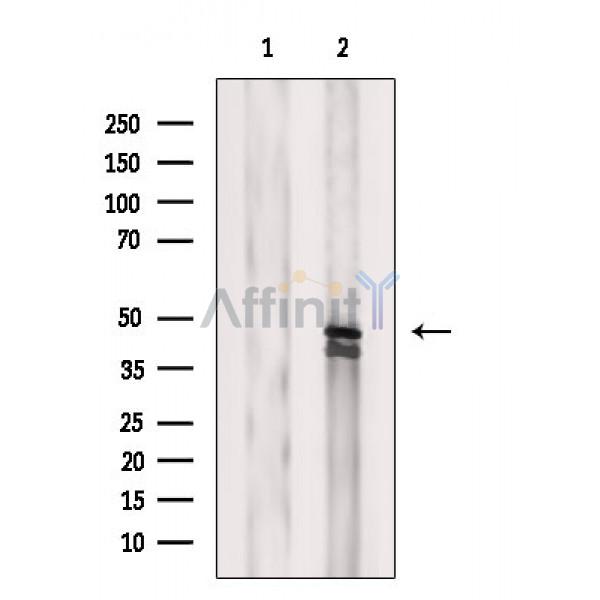 Валидация Affinity AF6658 - 3933