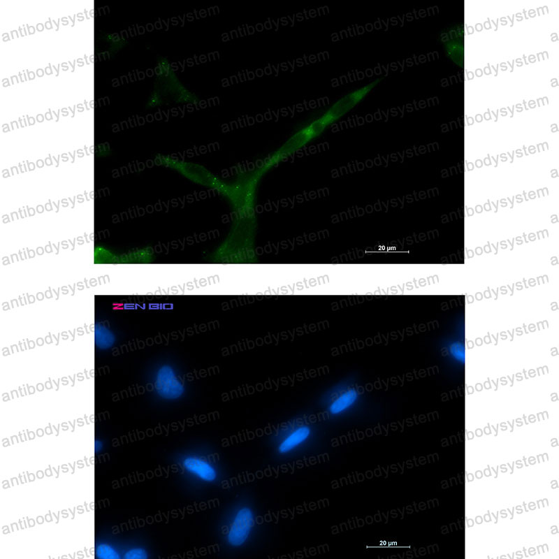 Валидация IF - AntibodySystem RHD65101