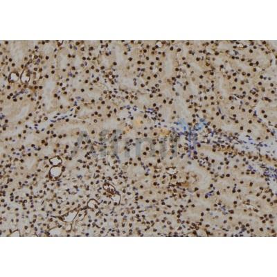 Валидация Affinity AF6062 - 3264