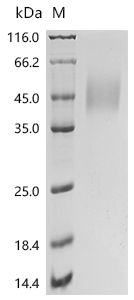 SDS-PAGE