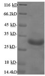 SDS-PAGE