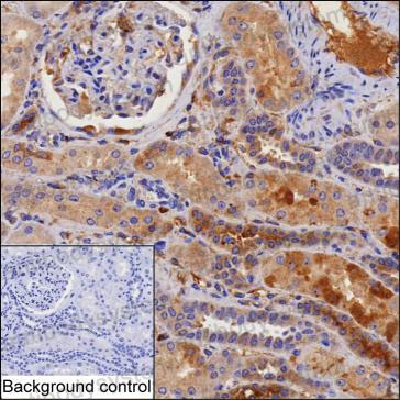 Валидация AntibodySystem RHB90602