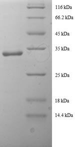 SDS-PAGE