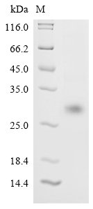 SDS-PAGE