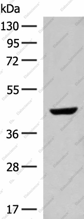 Вестерн-блоттинг, GNAT1, ткань печени плода человека
