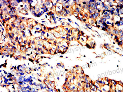 Валидация AntibodySystem RHG20802