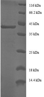 SDS-PAGE