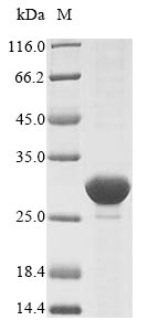 SDS-PAGE