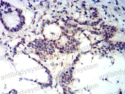 Валидация AntibodySystem RHN82802 (3894)