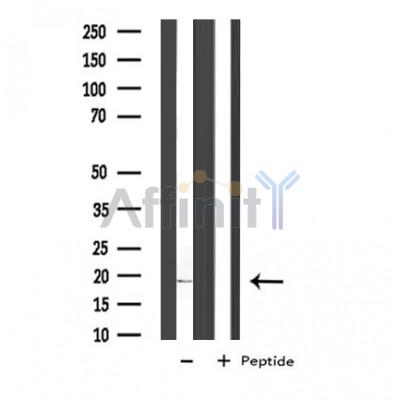 Валидация Affinity DF3561 - 14507