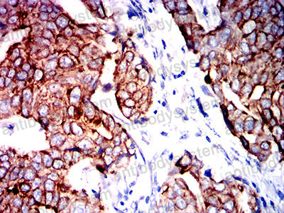 Валидация AntibodySystem RHE16201