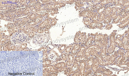 Валидация AntibodySystem RHC33013