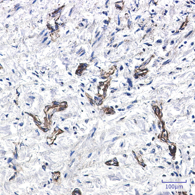 Валидация AntibodySystem RHE13202