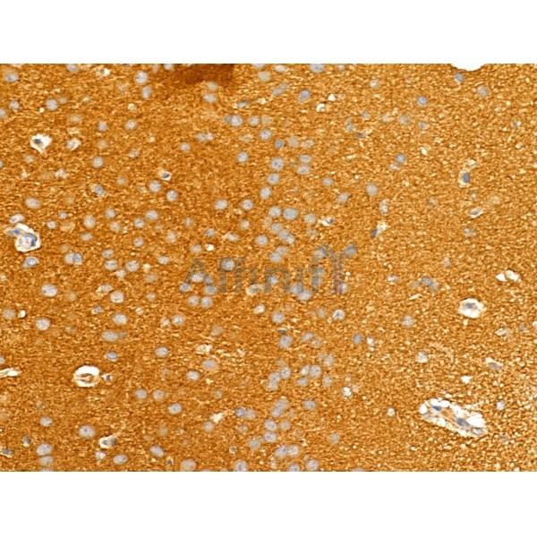 Валидация Affinity DF12194 - 6435