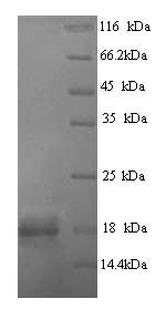 SDS-PAGE