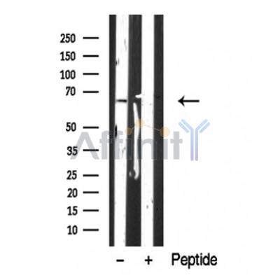 Валидация Affinity DF10352 - 5975