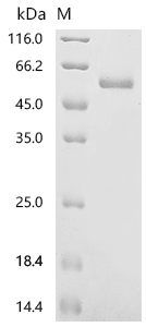 SDS-PAGE