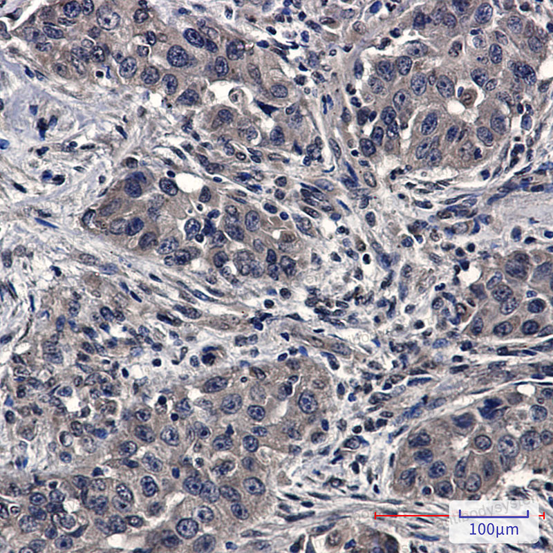 Валидация AntibodySystem RHE84901