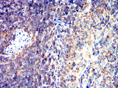 Валидация AntibodySystem RHJ16301 (3344)