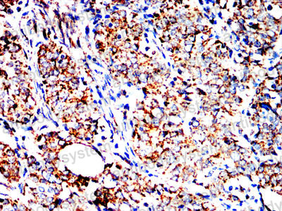 Валидация AntibodySystem RHE23203 (2038)