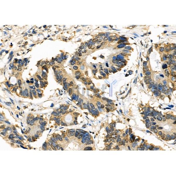 Валидация Affinity DF4257 - 15647