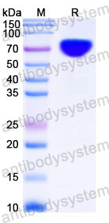 EHC43302, SDS-PAGE