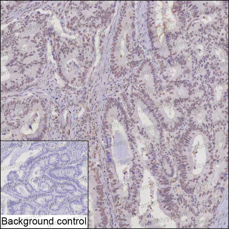 Валидация AntibodySystem RHD34703