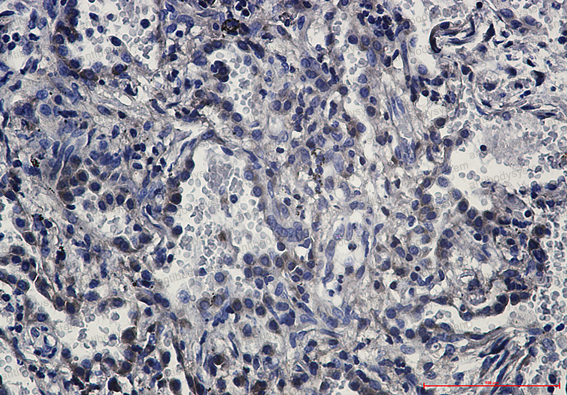 Валидация AntibodySystem RHD67202