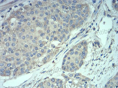 Валидация AntibodySystem RHE84004 (2361)