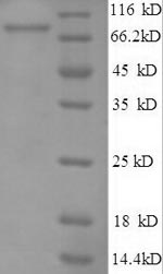 SDS-PAGE