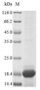 SDS-PAGE