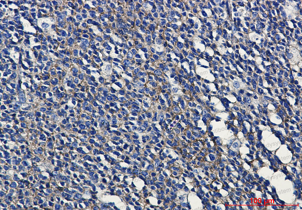 Валидация AntibodySystem RHM00104