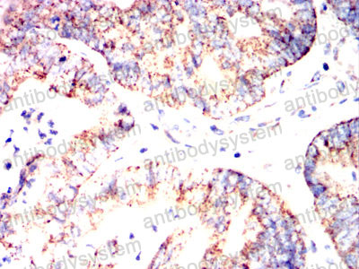 Валидация AntibodySystem RHN06802 (3791)