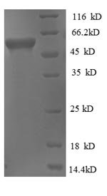 SDS-PAGE