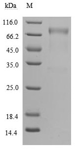 SDS-PAGE