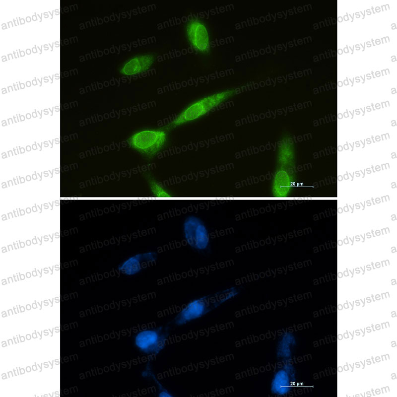 Валидация IF - AntibodySystem RHN88901