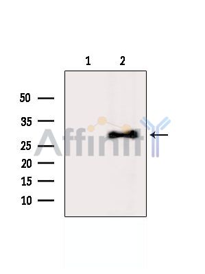 Валидация Affinity DF6195 - 17451